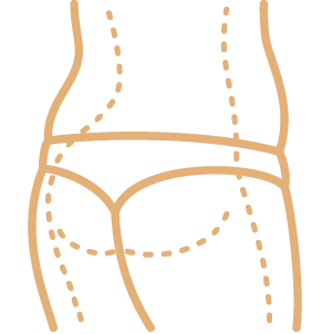 Gluteoplastia
